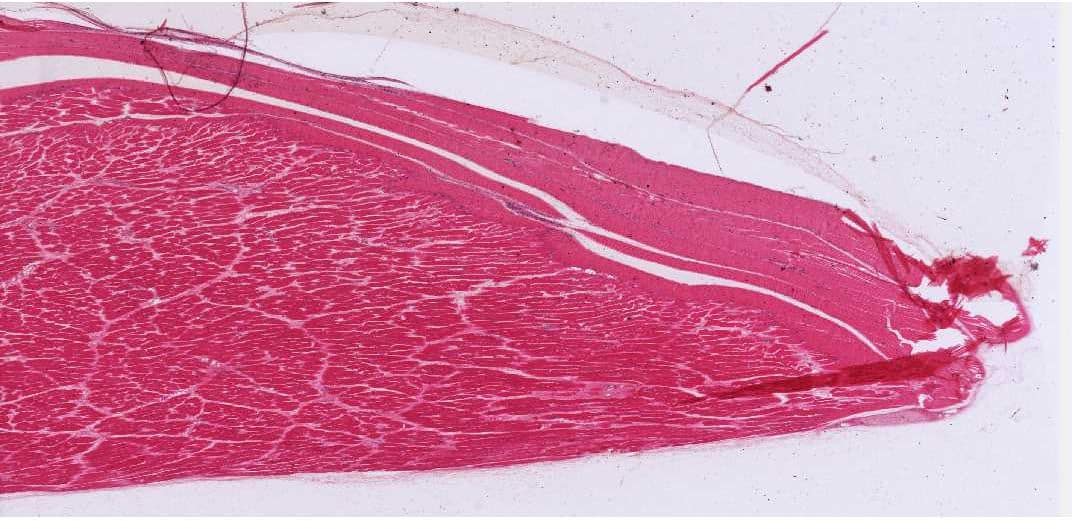 Srovnání muže a ženy z hlediska svalové hmoty